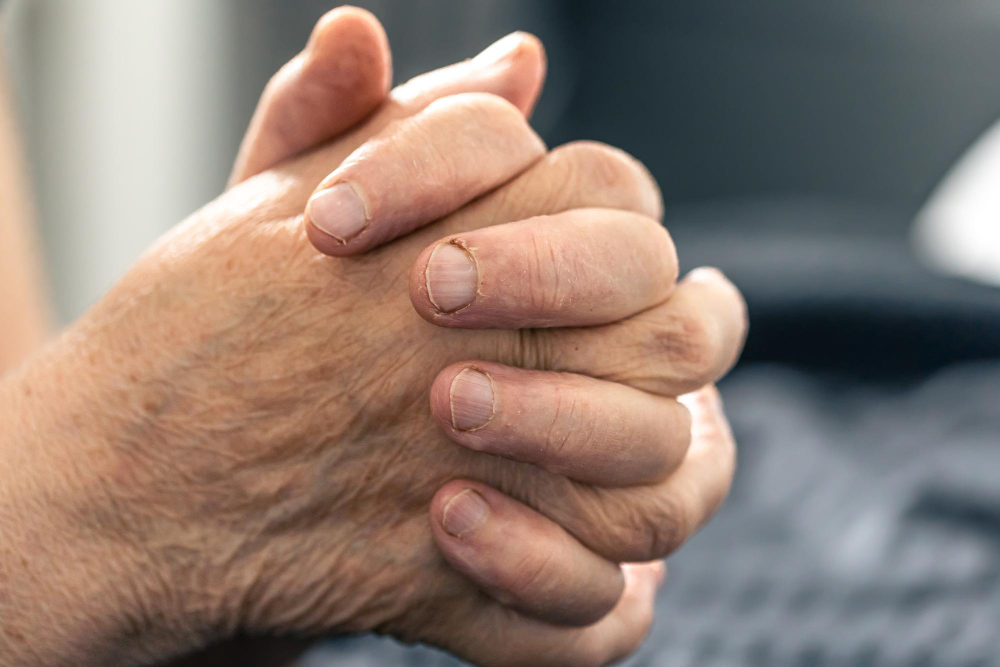 ปัญหามือบวมในผู้สูงอายุและผู้ป่วยติดเตียง